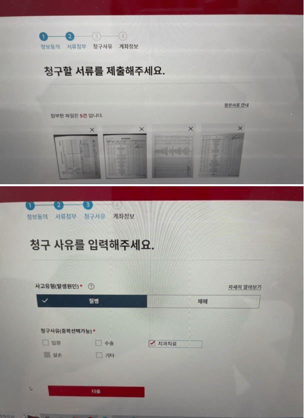 aia생명 실속보장치아보험 후기 4가지(청구방법, 보험금 공개)