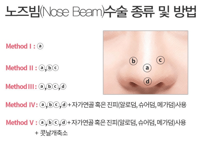 노즈빔 후기 11개(3일차~7개월차) 사진있음