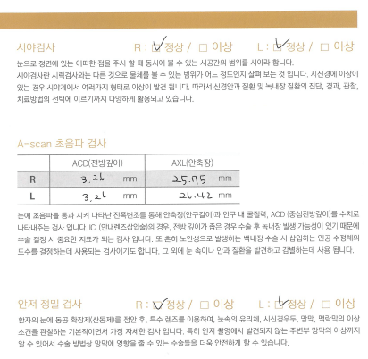 렌즈삽입술 후기 6가지(부작용 이야기 포함)