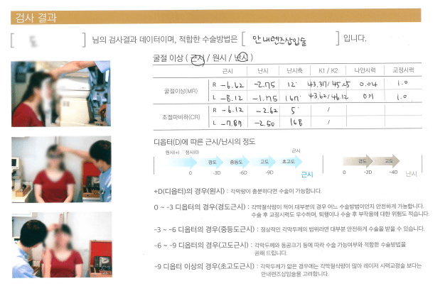 렌즈삽입술 후기 6가지(부작용 이야기 포함)