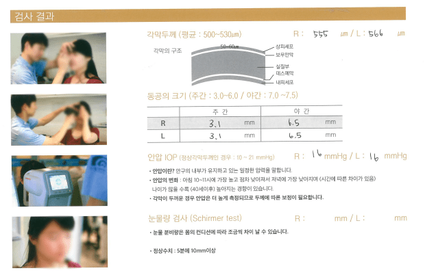 렌즈삽입술 후기 6가지(부작용 이야기 포함)