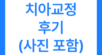 치아교정 후기 6가지 전후 사진 있음